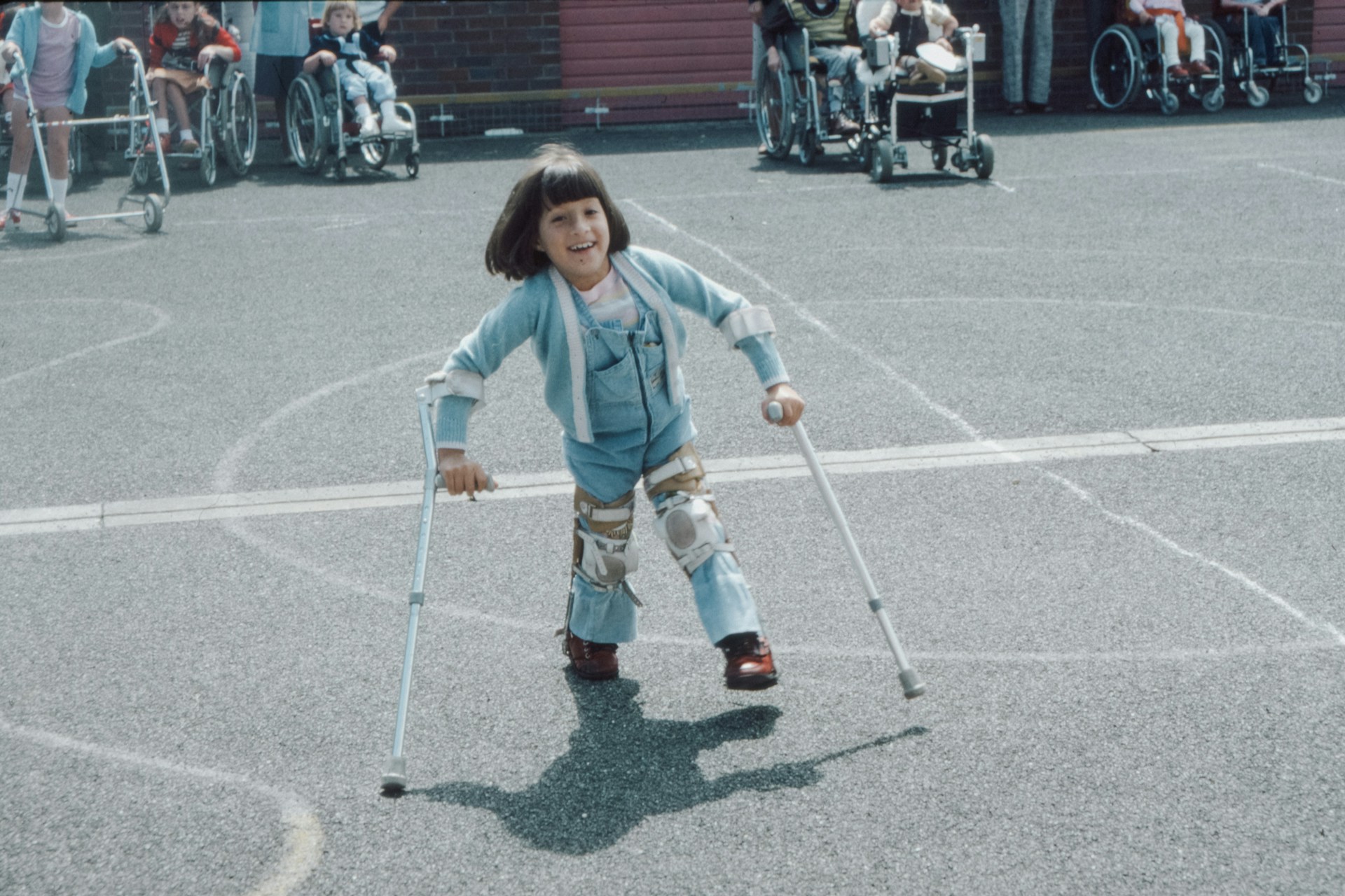 A young girl walking with crutches while smiling